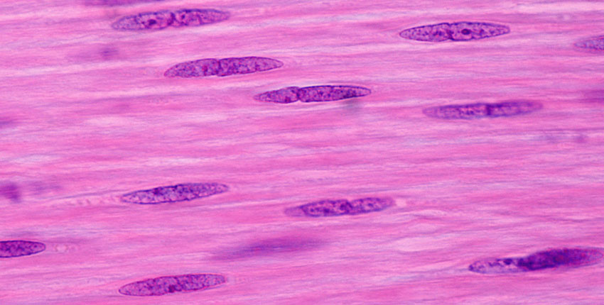 Photo of smooth muscle cells 