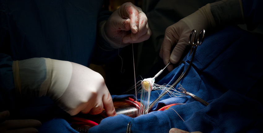 Photo of open heart surgery. 