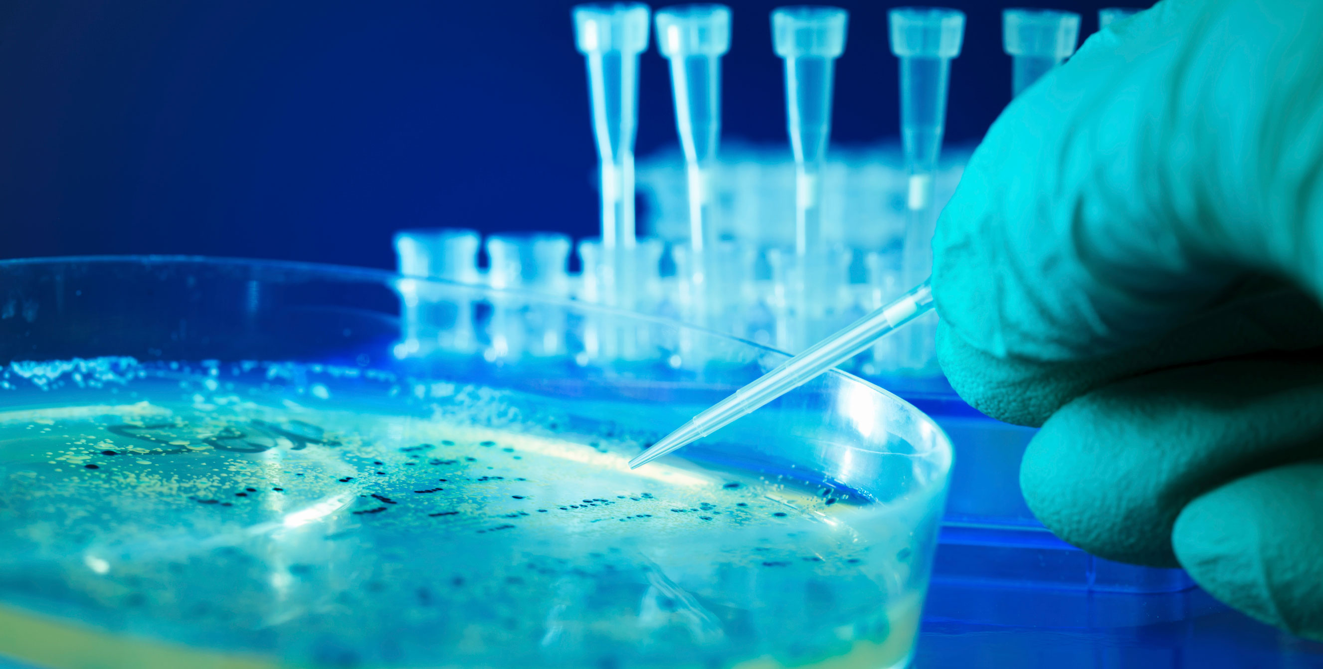 Stock image of a gloved hand working with a Petri dish, with test tubes in the background