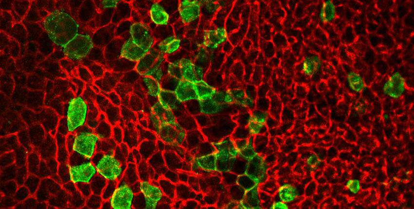 Photo of Brown adipocytes derived from progenitors expressing the Trpv1 receptor. 