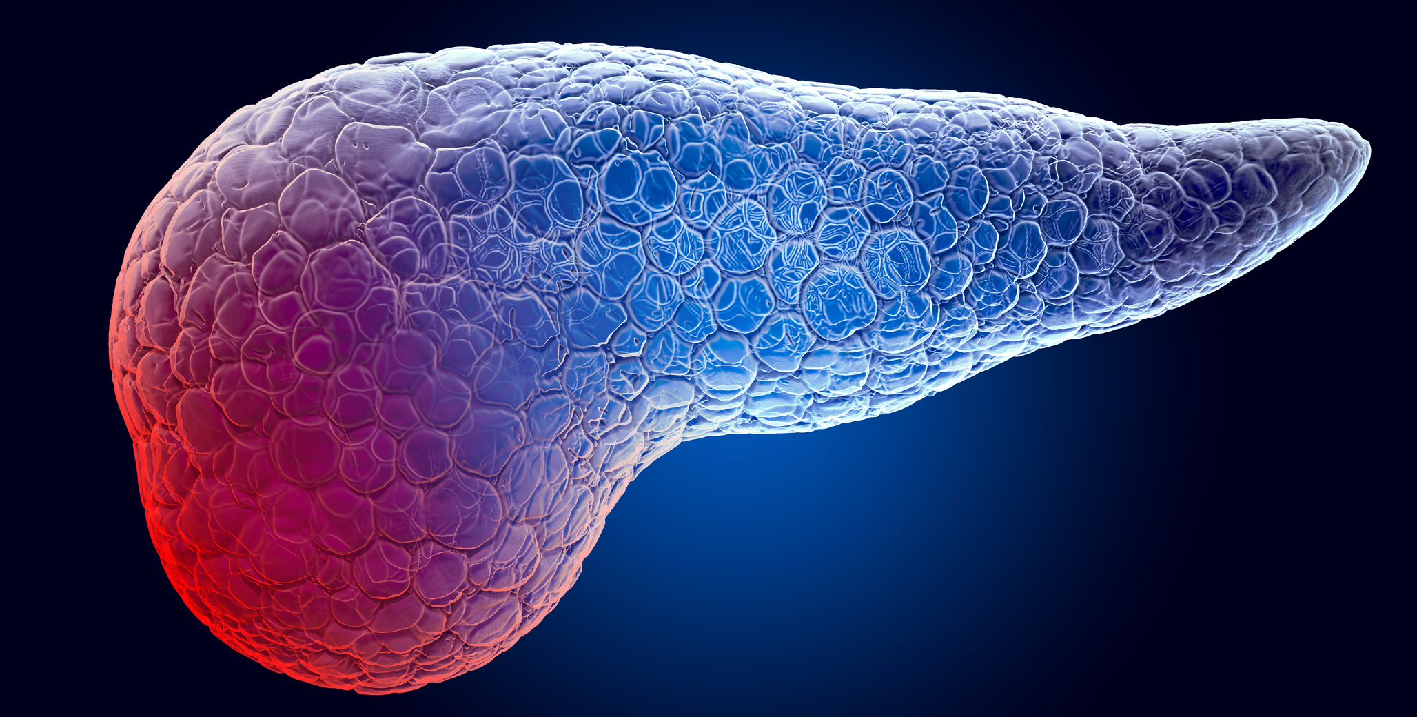 illustration of pancreas in blue and red; the red is meant to show pain