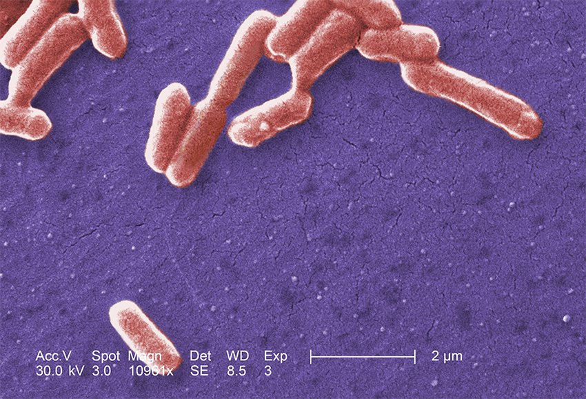 Micrograph with pill-shaped E. coli bacteria shown in pink against a purple background