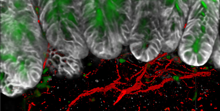 Image of nerves (red), goblet cells (green), and ephithelial cells (gray)