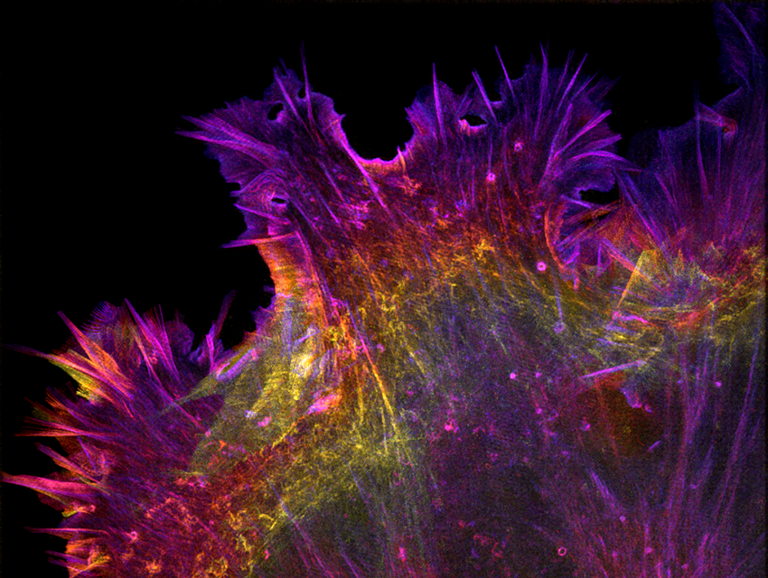 Spiky cell in pink, purple, orange and yellow