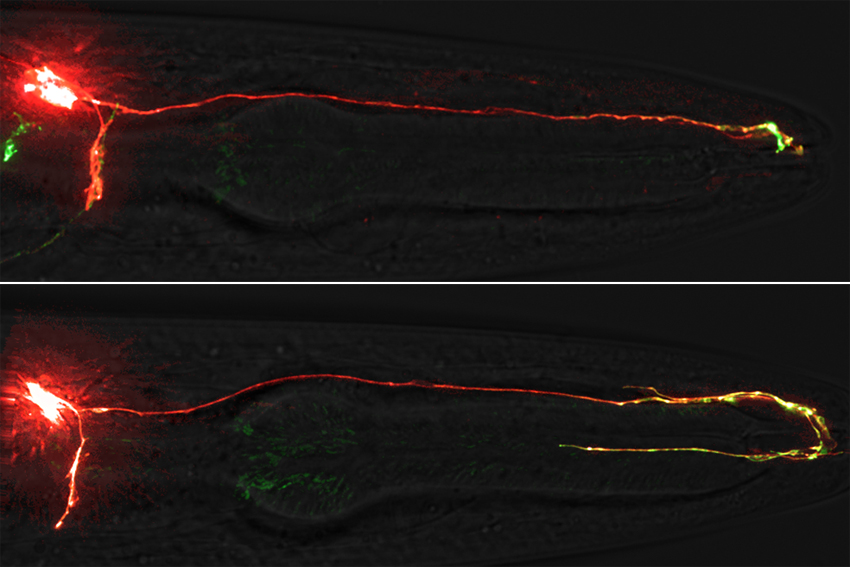 fluorescent neuron of normal length on top and overgrown at bottom
