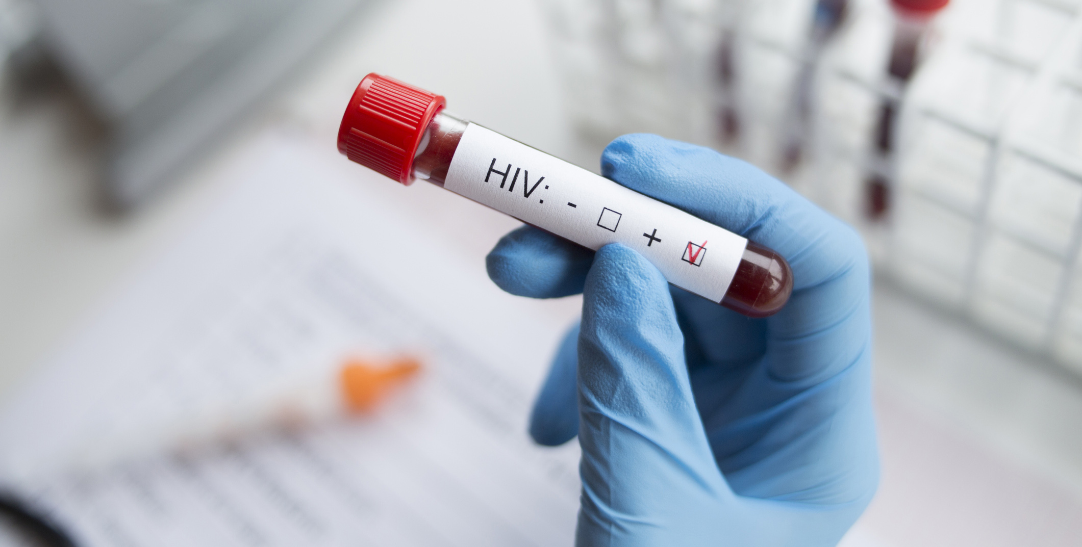 Photo of a gloved hand grasping a blood-test tube labeled "HIV+"; hand is wearing a blue medical glove; background is blurred blood-test tubes and notebook