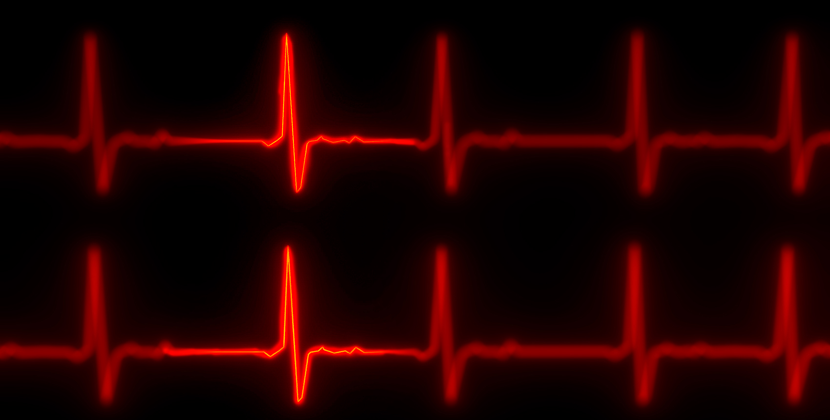 Two horizontal red lines punctuated with jagged peaks representing a heart beat on an electrocardiogram