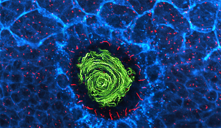 microscopy image of cilia helping shape organ positioning during development