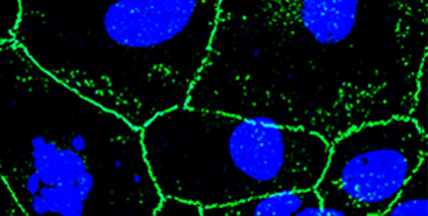 Confocal microscopy image of a whole mount of female mouse CE at 3 months post 500 J/cm2 UVA (green: ZO-1 staining (tight membrane junctions); blue: nuclear staining using DAPI)