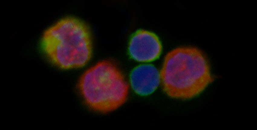 T cells glow blue, red and yellow