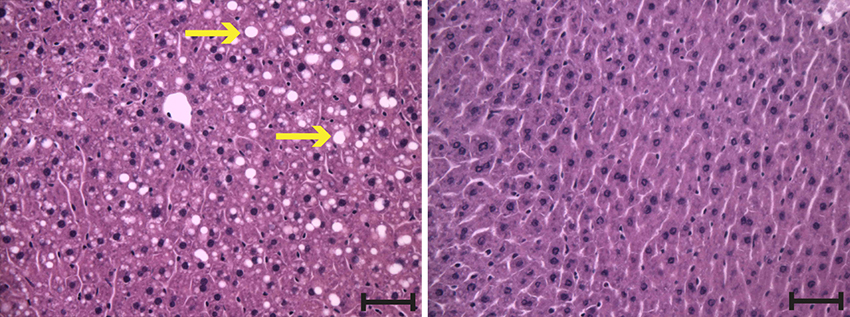 Histology slides show lipid molecules in mouse livers