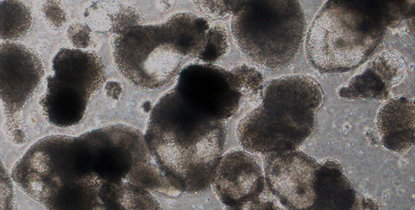 HMS researchers have made a mix of blood progenitor cells, shown here, and blood stem cells.