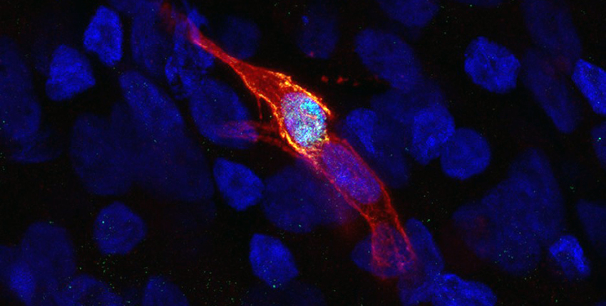 an elongated cell glows orange around the edges against a dark background in a fluorescently-tagged microscope image