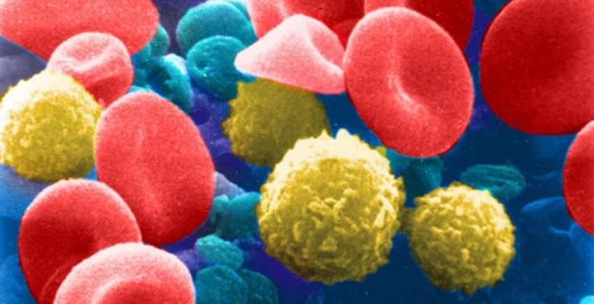 Micrograph of disc-shaped red blood cells and ball-shaped white blood cells on colorized blue background