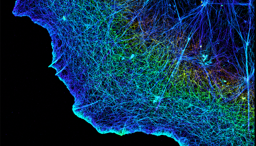 Fluorescent dye lights up actin strings in a cell in a rainbow of colors. The cell edge glows in a shape like a fried egg against a black backdrop.