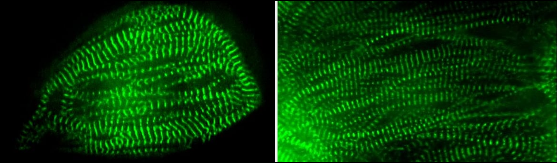 beating heart cells