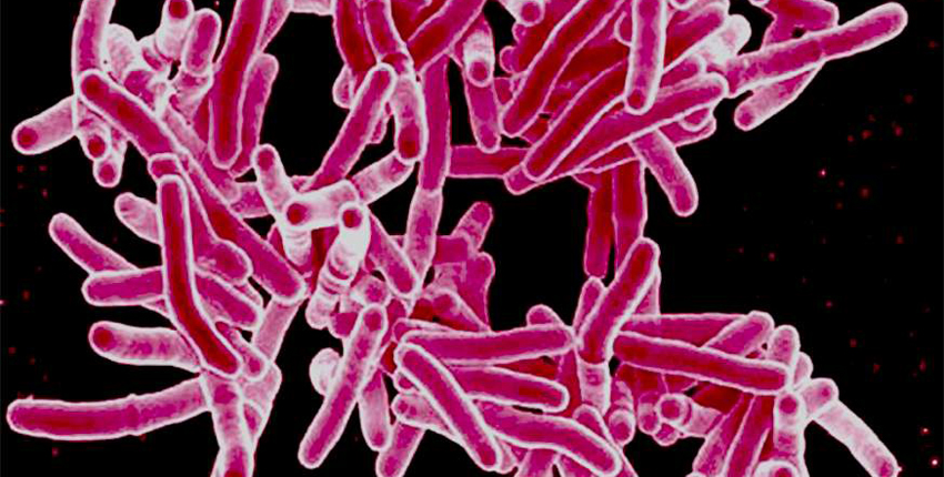 Rod-shaped TB bacteria