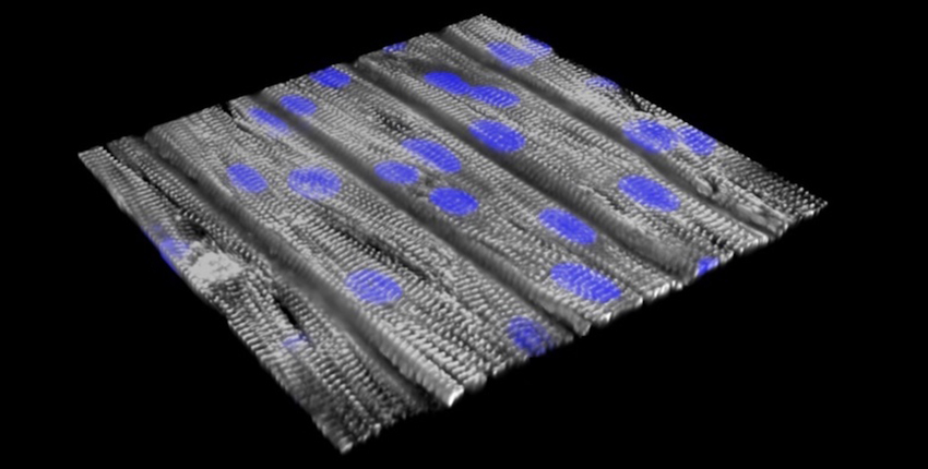 Flat sheet with gray muscle fibers and purple nuclei