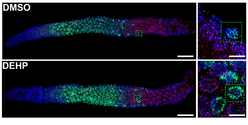 Two images of cells throughout worm bodies are colored blue, green and pink. Each has an inset box detailing normal and abnormal features in a single egg.