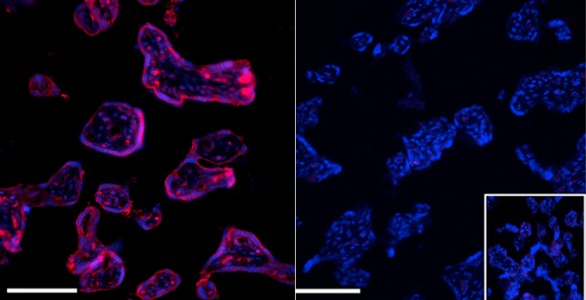 Side by side micrographs show cells lit in purple (left) and blue (right) against a black background
