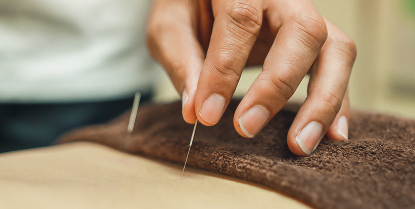 acupuncture needles being inserted in a patient
