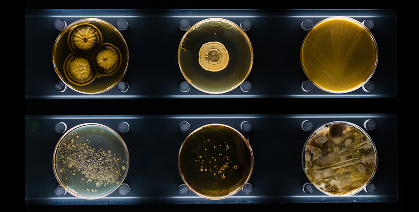 six Petri dishes containing different types of bacteria