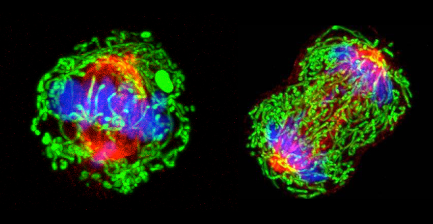 breast cancer cell dividing
