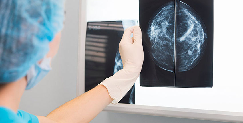 A clinician (a doctor or a nurse) looks at an X-ray scan of breast cancer