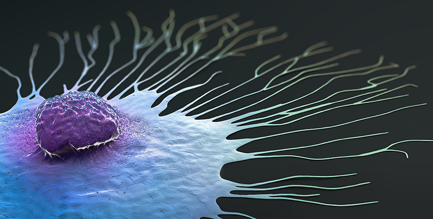 Digital illustration of a single breast cancer cell spreading