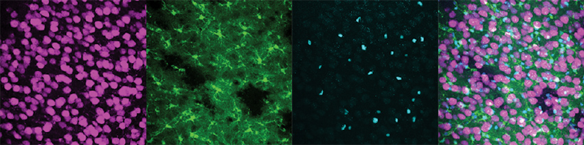four microscopy images in green, purple and blue
