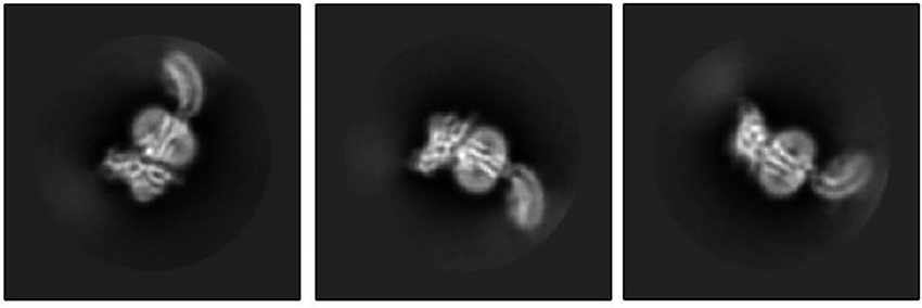 Three black-and-white microscope images of a protein with three segments, the third one curved like a tail