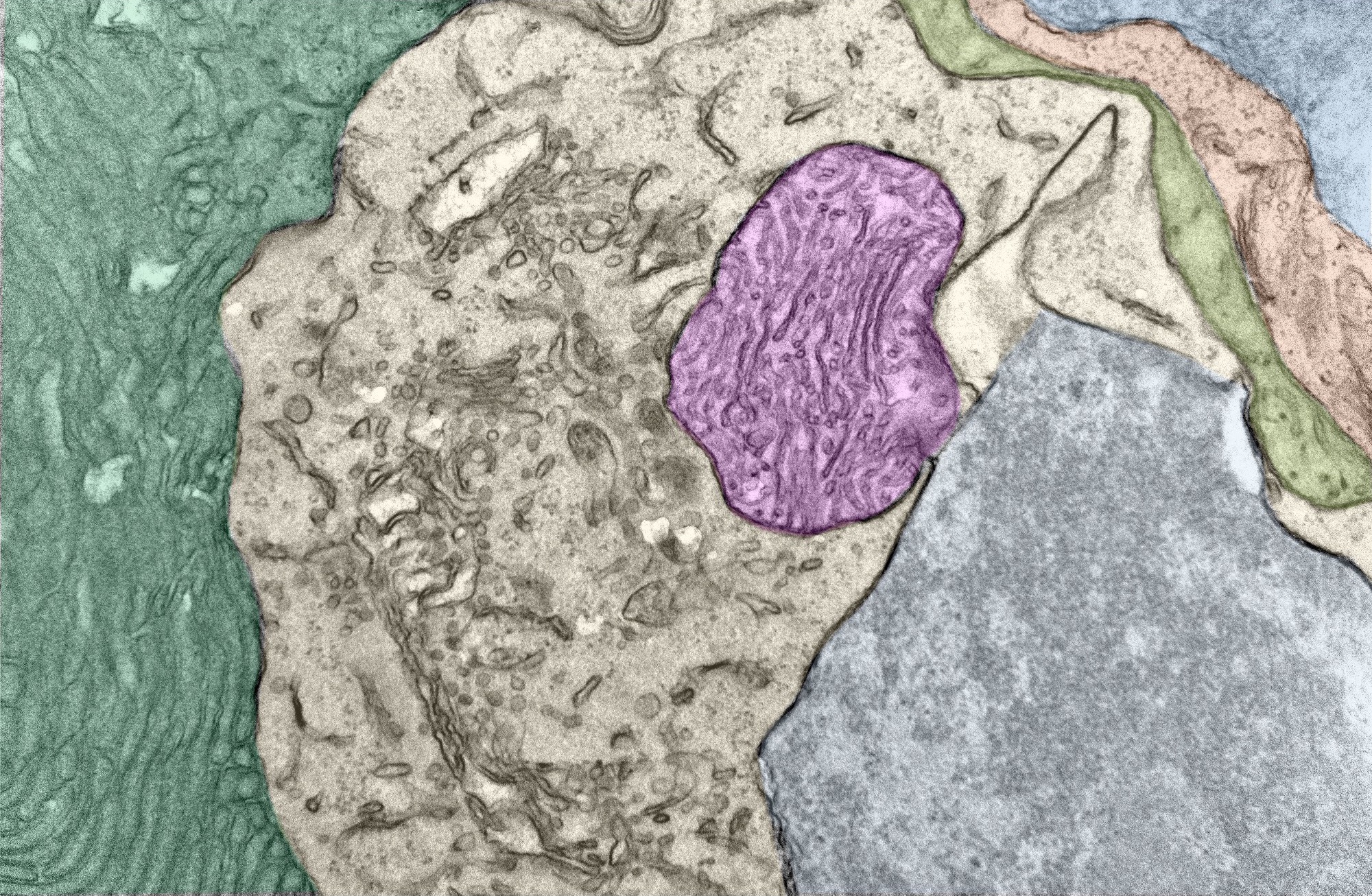 Colorized micrograph shows a magenta blob amid gray and beige blobs, with a green background