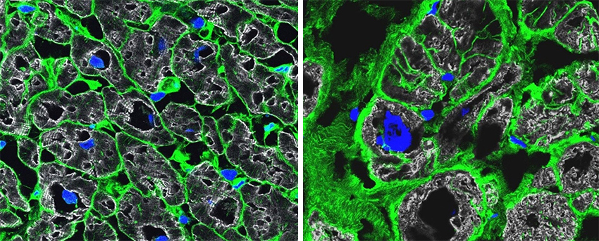 Microscopy shows cells in green and nuclei in blue