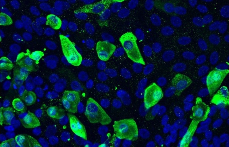 Magnified cells glow green and blue against a black background