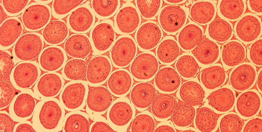 cross-sections of orange-stained spheres