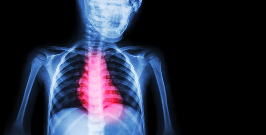 Illustration of reddened heart against blue skeleton X-ray