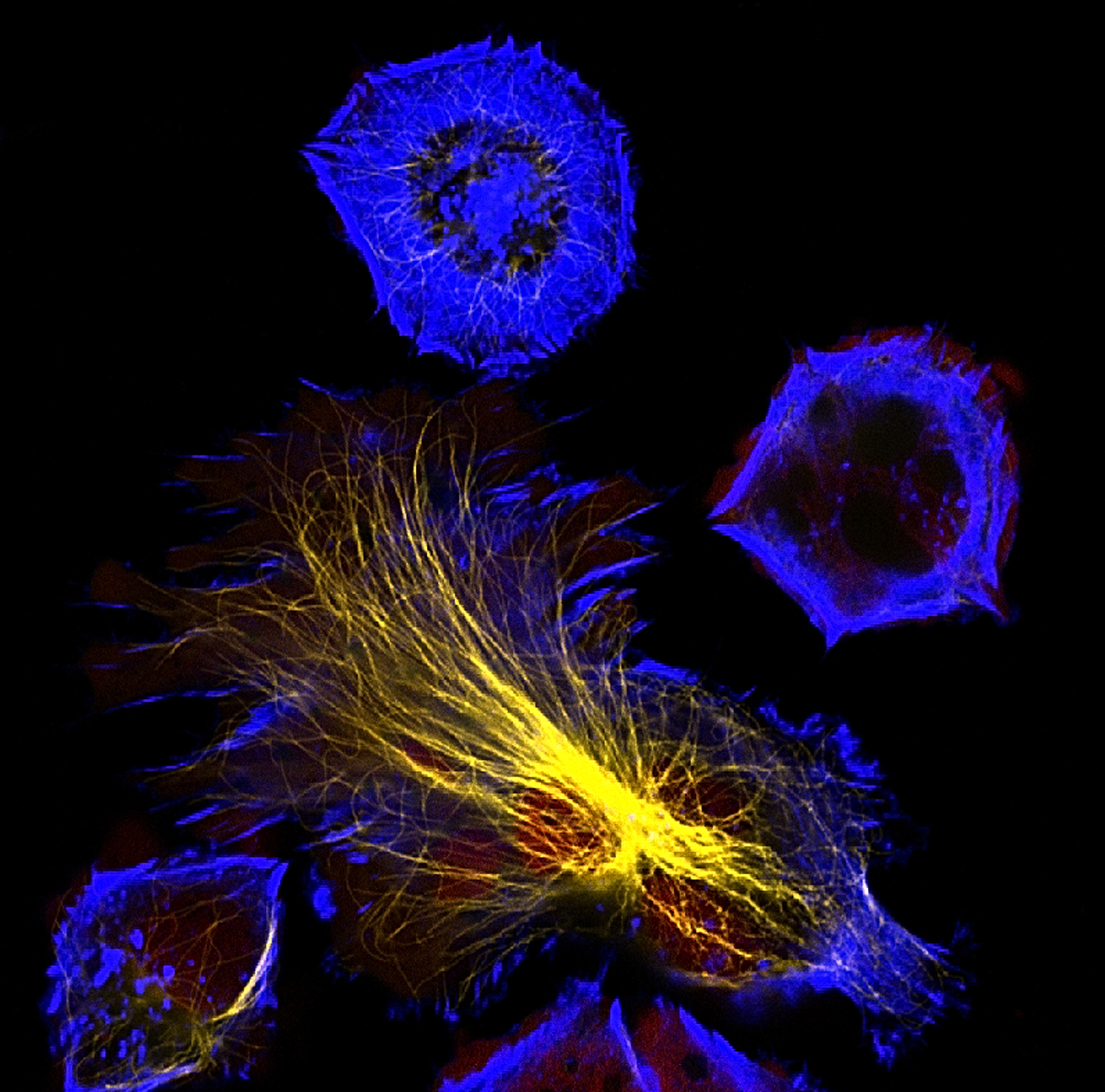 neuroblastoma cells