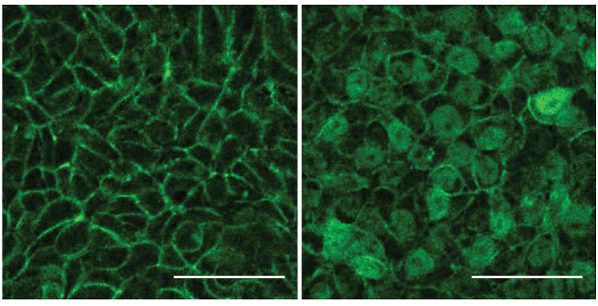 Two micrographs side by side wih green-stained cells arranged in different patterns