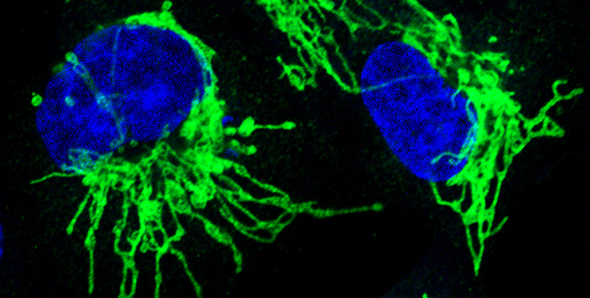 Microscopy image of two cell nuclei in blue and spindly misshapen mitochondria in green against a black background