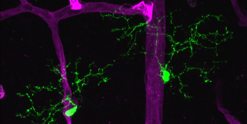 retinal microglia and retinal vasculature