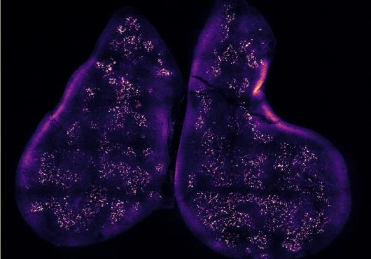 image of the thymus gland