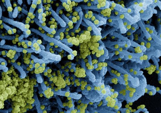 Tiny spheres of SARS-CoV-2 cover the tubular surface of a cell