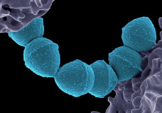 Colorized microcsope image shows six knob-like bacteria on a string