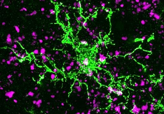 microscope image of a cell spreads out bright green against a dark background, while synapses between cells appear as scattered purple patches throughout the image