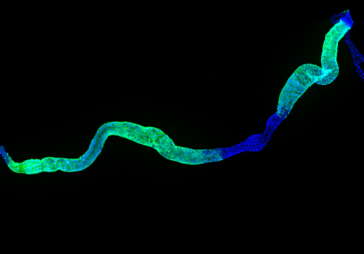 Fruit fly gut cells glow green and blue in a microscopy image against a dark background
