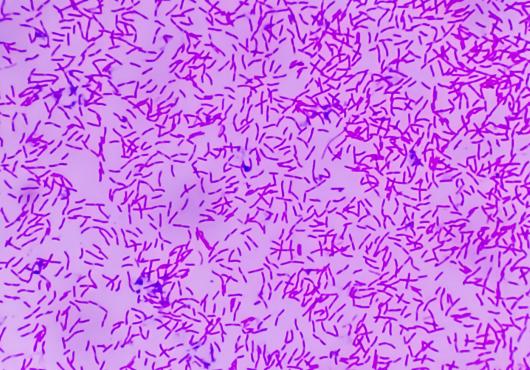 Hundreds of rod-shaped bacteria, colorized magenta, strewn across a pink background