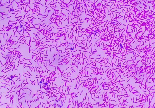 Hundreds of rod-shaped bacteria, colorized magenta, strewn across a pink background.
