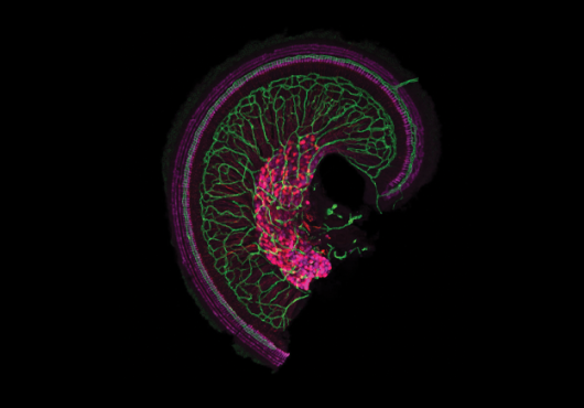 The apex of the snail-shaped cochlea with dense vascular network shown in green, as well as hair cells and cell bodies and axons of auditory neurons shown in magenta.