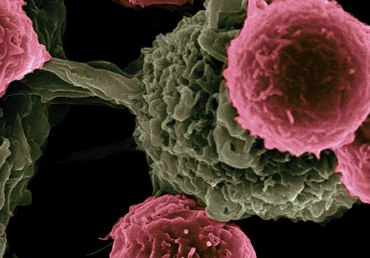 Microscopy image of four spheres (T cells) in front of a large structure with a sphere connected to a main body by a stalk(dendritic cell)