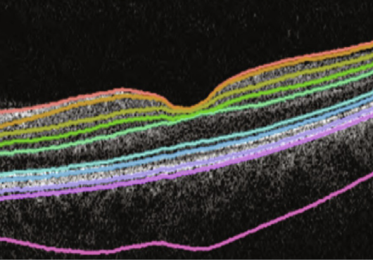 Different colored lines showing thickness layers on a black background